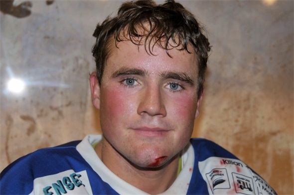 Hockeyler sind hart im Nehmen. Flöcki spielte trotz «Schnatte» zu Ende.