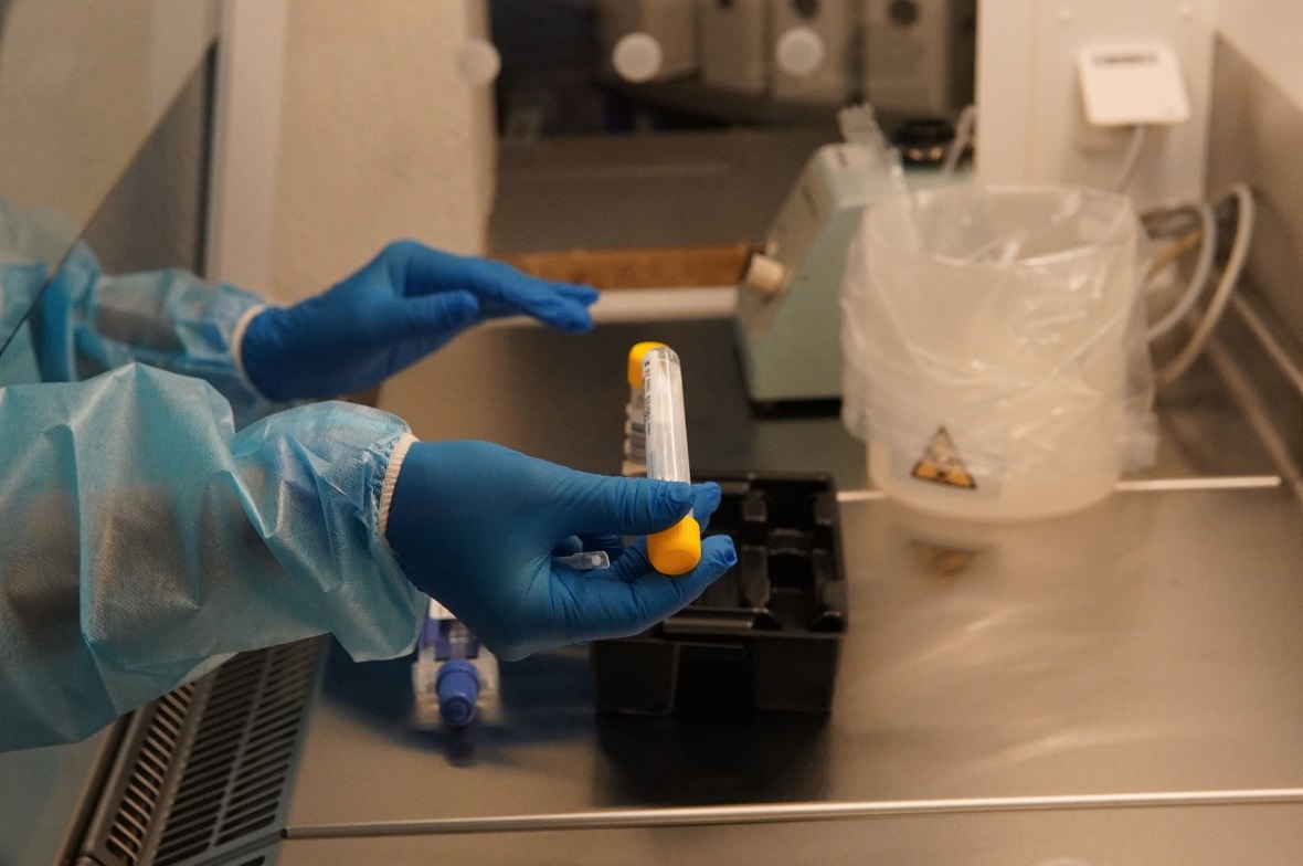 Vorbereitung einer Probe für den PCR-Test.